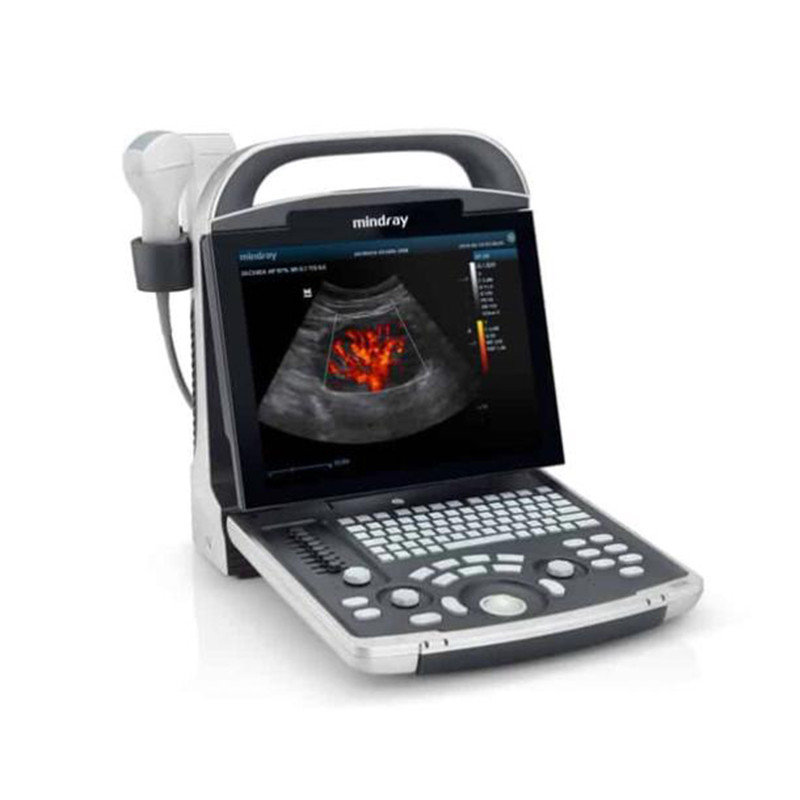 Mindray DP 30  power Portable Ultrasound Machine