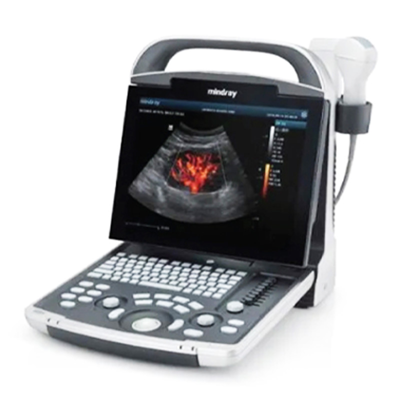 Mindray DP 30T Power Digital Ultrasonic Imaging System