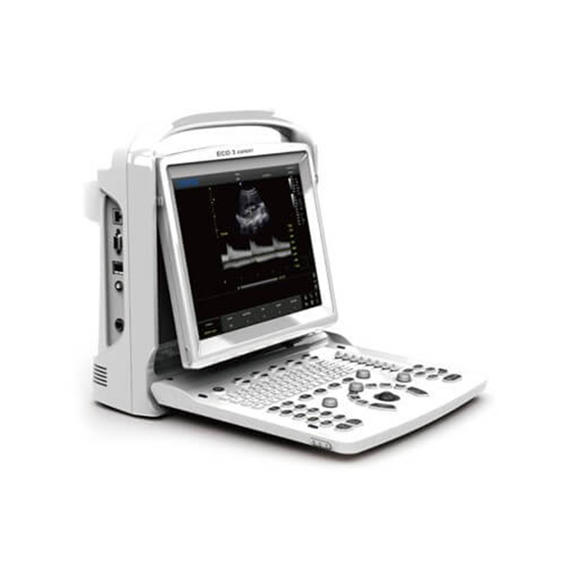 Chison ECO 3 Expert Portable Ultrasound machine